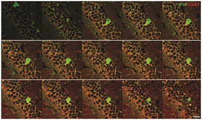 Confocal Synaptology: Synaptic Rearrangements in Neurodegenerative Disorders and upon Nervous System Injury